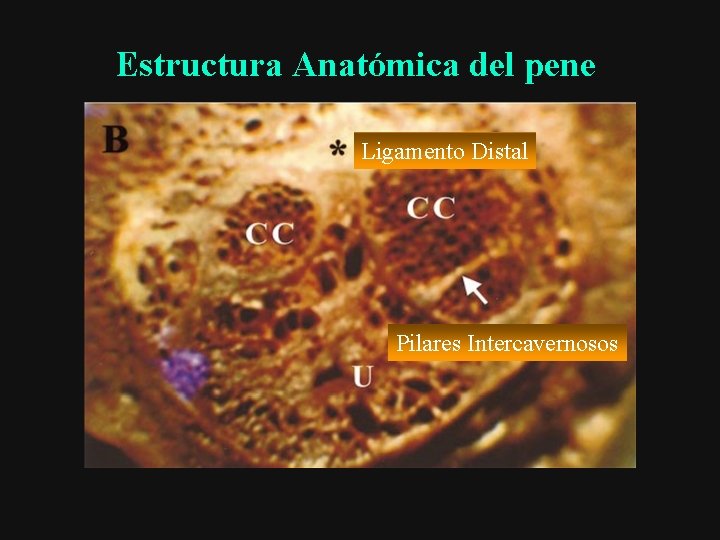 Estructura Anatómica del pene Ligamento Distal Pilares Intercavernosos 