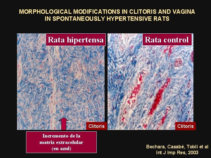 MORPHOLOGICAL MODIFICATIONS IN CLITORIS AND VAGINA IN SPONTANEOUSLY HYPERTENSIVE RATS Rata hipertensa Clítoris Incremento