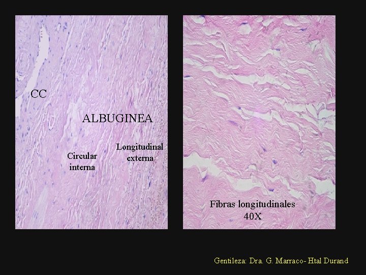 CC ALBUGINEA Circular interna Longitudinal externa Fibras longitudinales 40 X Gentileza: Dra. G. Marraco-