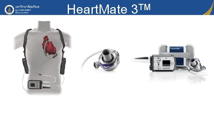 Heart. Mate 3 TM 