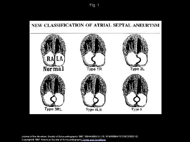 Fig. 1 Journal of the American Society of Echocardiography 1997 10644 -656 DOI: (10.