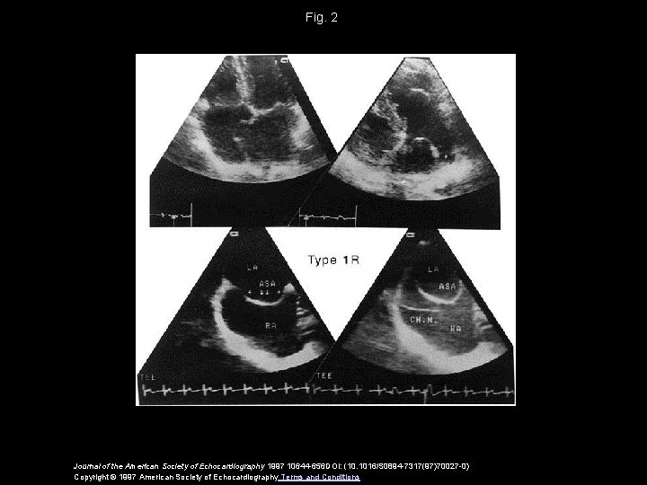 Fig. 2 Journal of the American Society of Echocardiography 1997 10644 -656 DOI: (10.