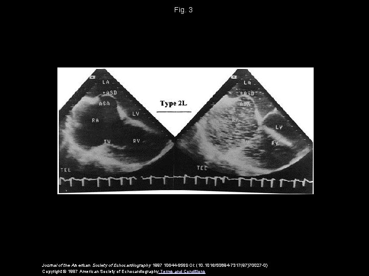 Fig. 3 Journal of the American Society of Echocardiography 1997 10644 -656 DOI: (10.