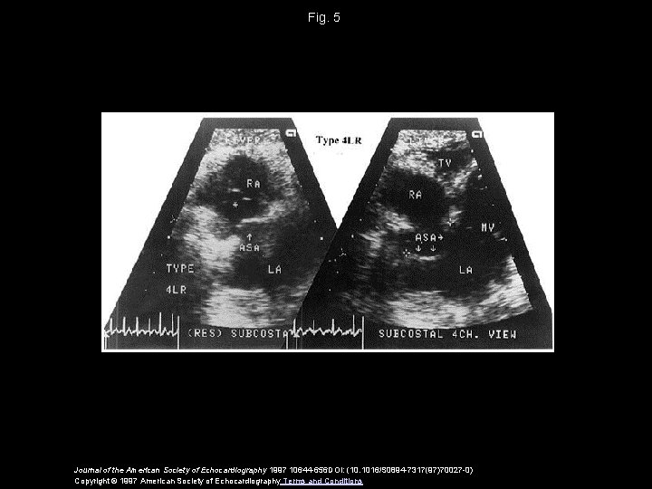 Fig. 5 Journal of the American Society of Echocardiography 1997 10644 -656 DOI: (10.