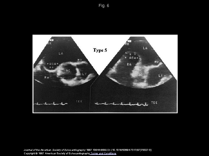 Fig. 6 Journal of the American Society of Echocardiography 1997 10644 -656 DOI: (10.