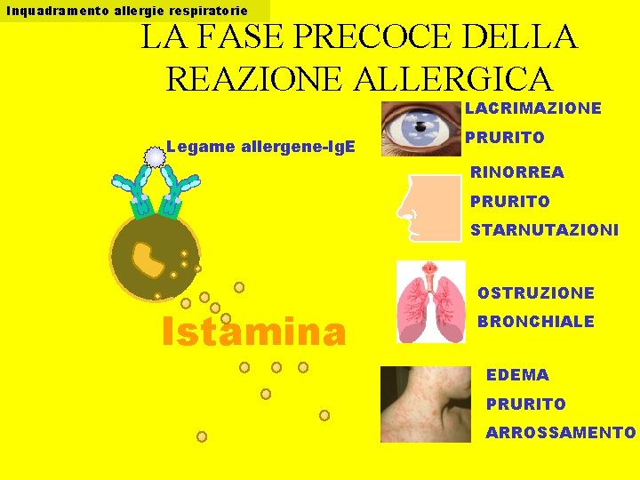 Inquadramento allergie respiratorie LA FASE PRECOCE DELLA REAZIONE ALLERGICA LACRIMAZIONE Legame allergene-Ig. E PRURITO
