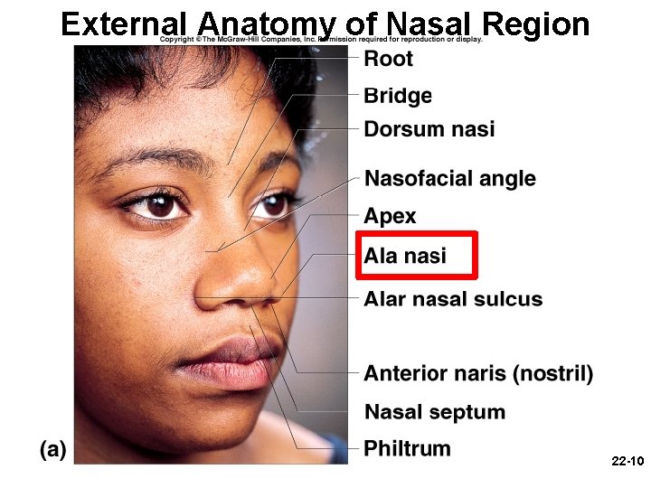 External Anatomy of Nasal Region 22 -10 