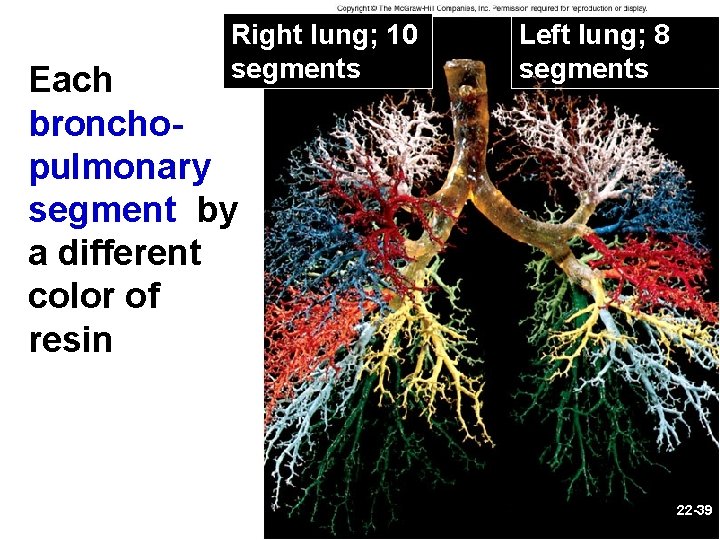 Right lung; 10 segments CO 22 Each bronchopulmonary segment by a different color of