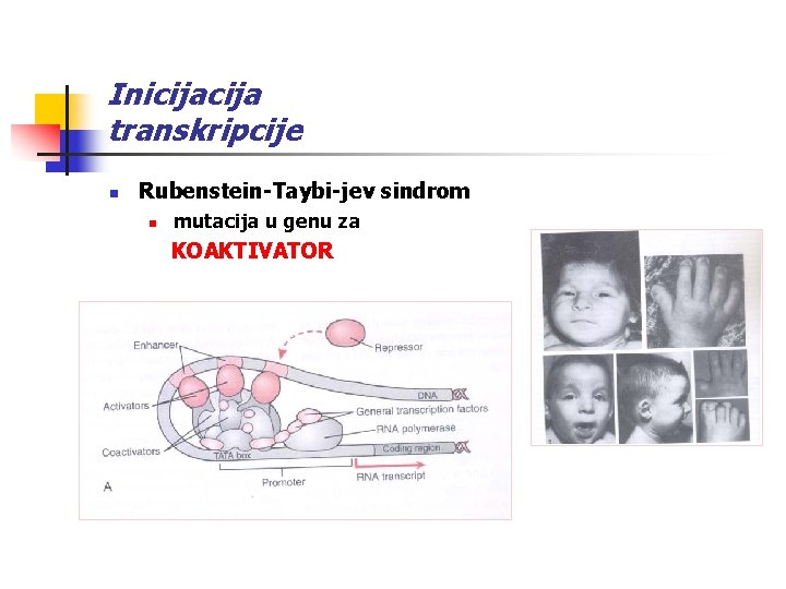 Inicija transkripcije n Rubenstein-Taybi-jev sindrom n mutacija u genu za KOAKTIVATOR 