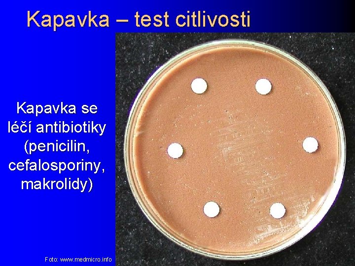 Kapavka – test citlivosti Kapavka se léčí antibiotiky (penicilin, cefalosporiny, makrolidy) Foto: www. medmicro.