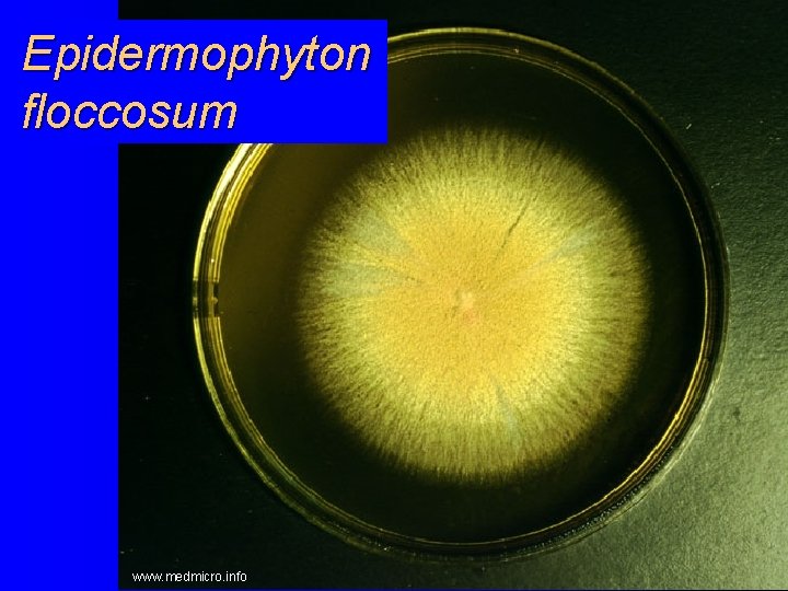 Epidermophyton floccosum www. medmicro. info 