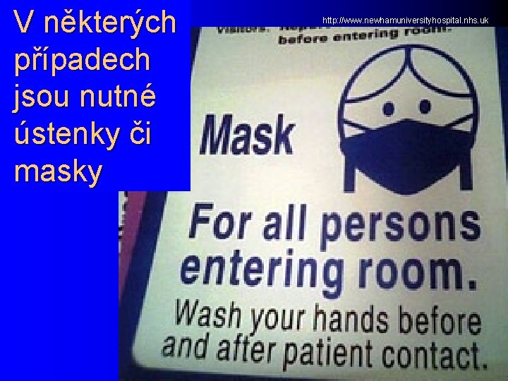 V některých případech jsou nutné ústenky či masky http: //www. newhamuniversityhospital. nhs. uk 