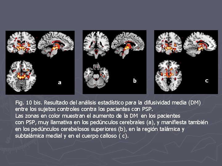 a b c Fig. 10 bis. Resultado del análisis estadístico para la difusividad media