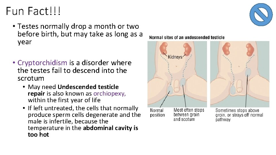 Fun Fact!!! • Testes normally drop a month or two before birth, but may