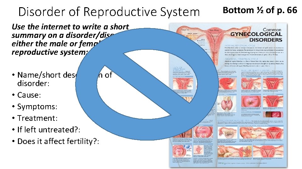 Disorder of Reproductive System Use the internet to write a short summary on a