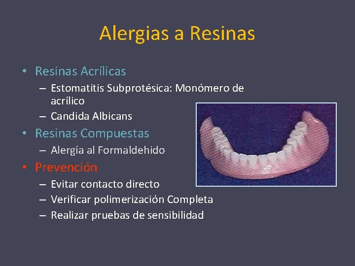 Alergias a Resinas • Resinas Acrílicas – Estomatitis Subprotésica: Monómero de acrílico – Candida