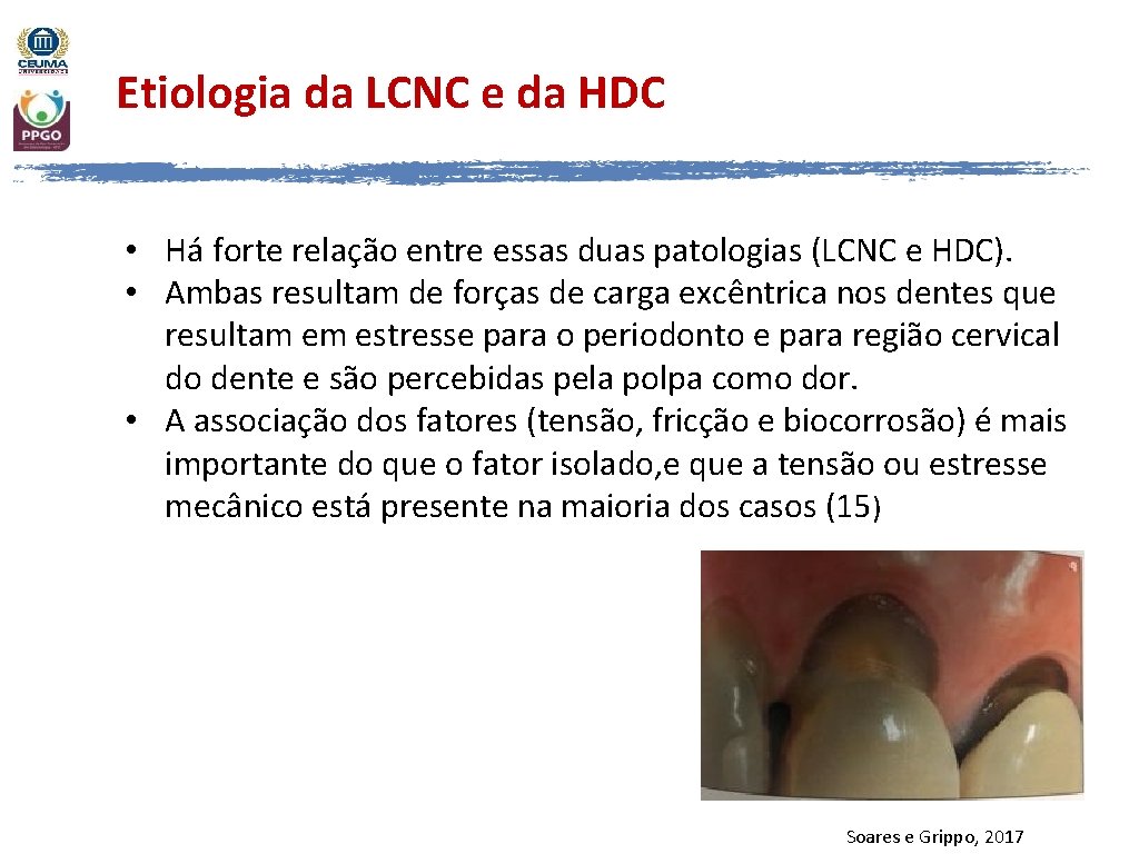 Etiologia da LCNC e da HDC • Há forte relação entre essas duas patologias