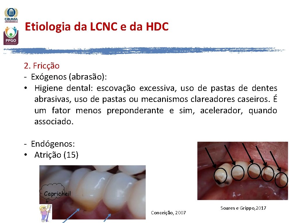 Etiologia da LCNC e da HDC 2. Fricção - Exógenos (abrasão): • Higiene dental: