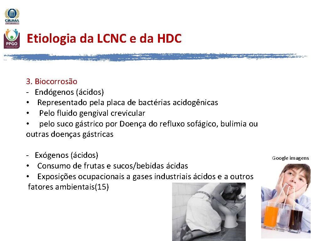 Etiologia da LCNC e da HDC 3. Biocorrosão - Endógenos (ácidos) • Representado pela