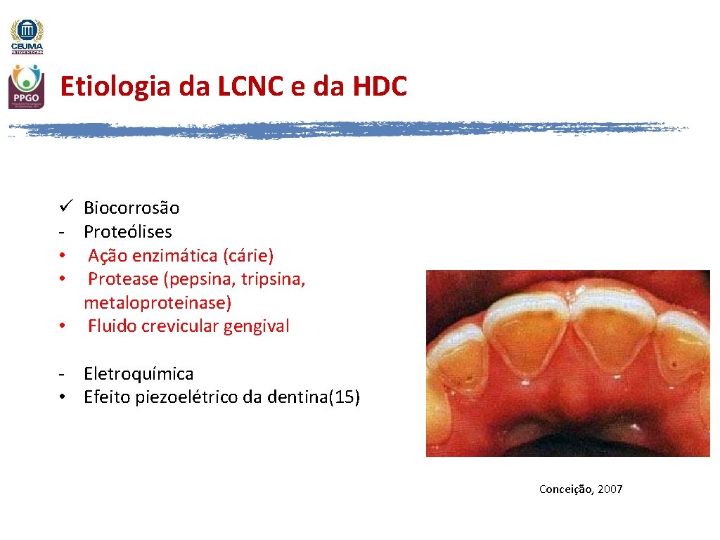 Etiologia da LCNC e da HDC Biocorrosão Proteólises Ação enzimática (cárie) Protease (pepsina, tripsina,