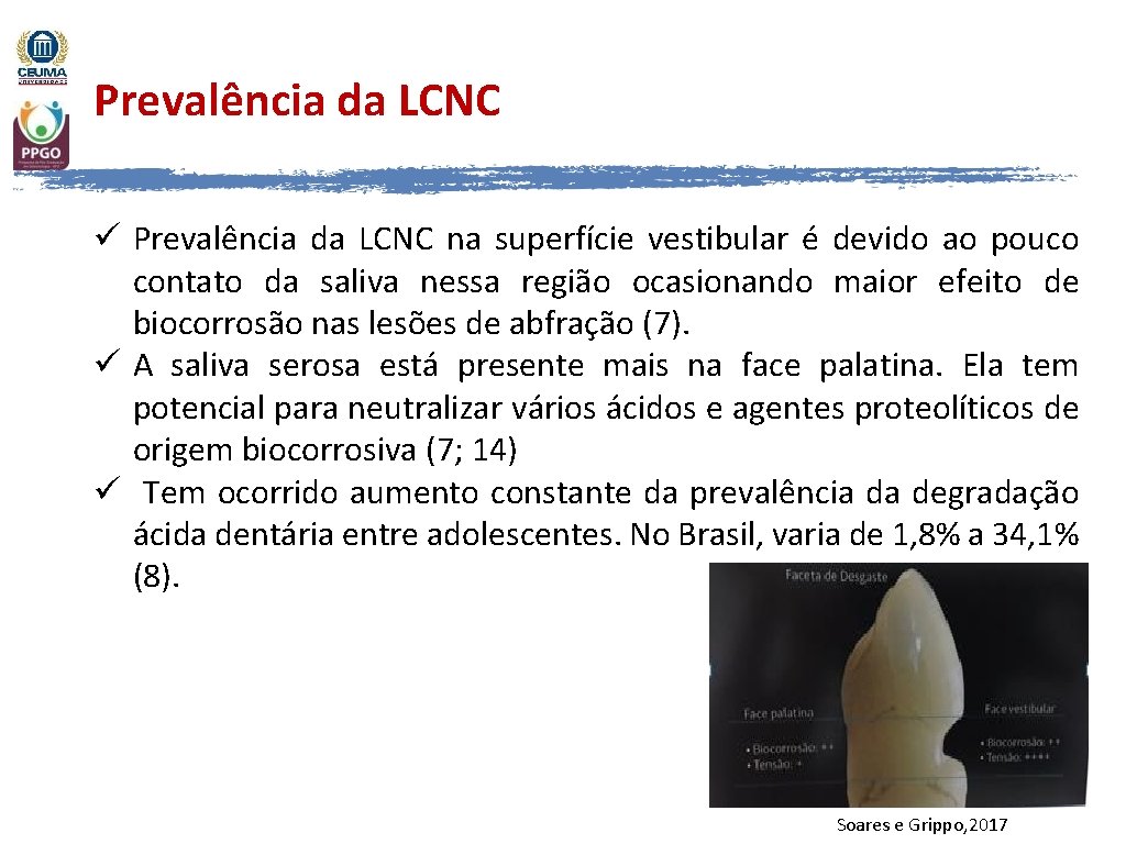 Prevalência da LCNC ü Prevalência da LCNC na superfície vestibular é devido ao pouco