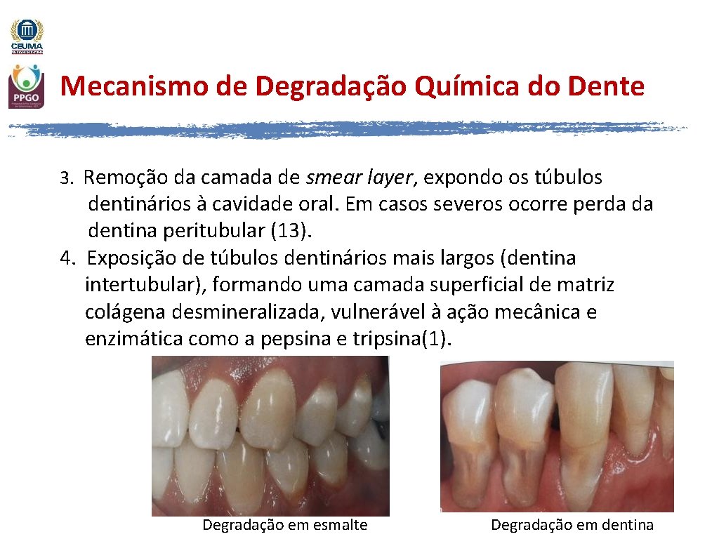 Mecanismo de Degradação Química do Dente 3. Remoção da camada de smear layer, expondo