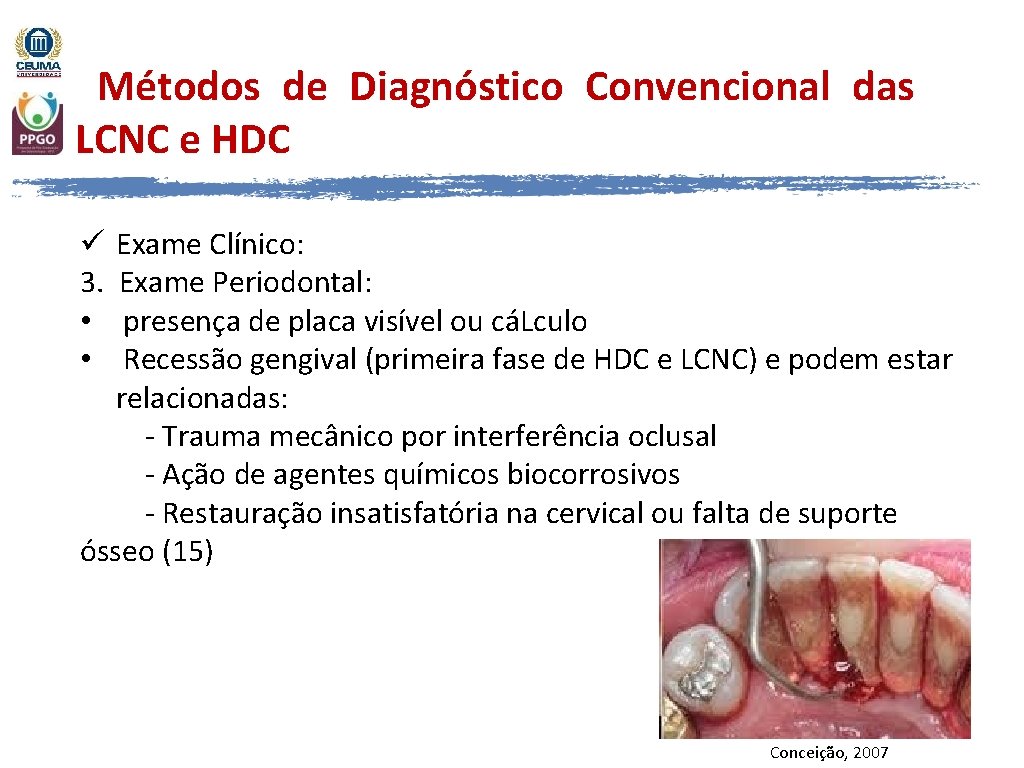 Métodos de Diagnóstico Convencional das LCNC e HDC Exame Clínico: Exame Periodontal: presença de