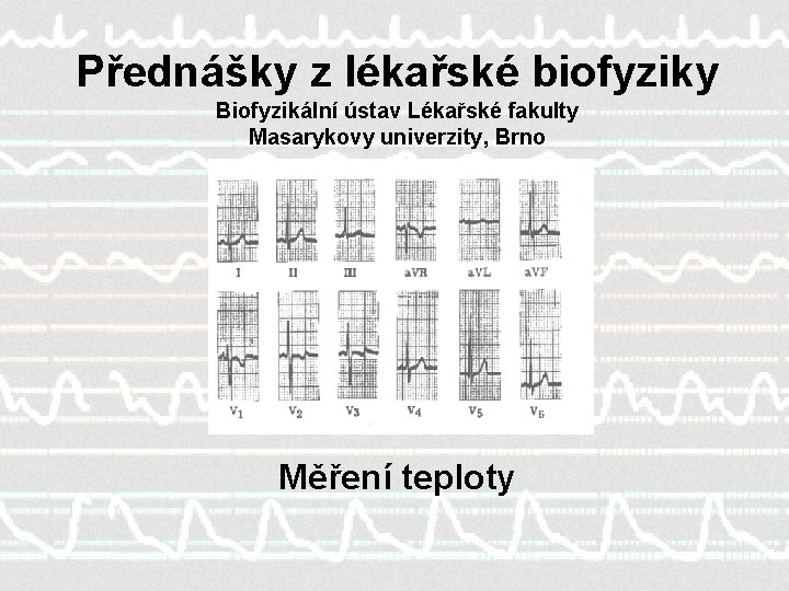 Přednášky z lékařské biofyziky Biofyzikální ústav Lékařské fakulty Masarykovy univerzity, Brno Měření teploty 