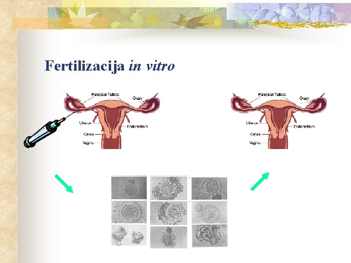 Fertilizacija in vitro 