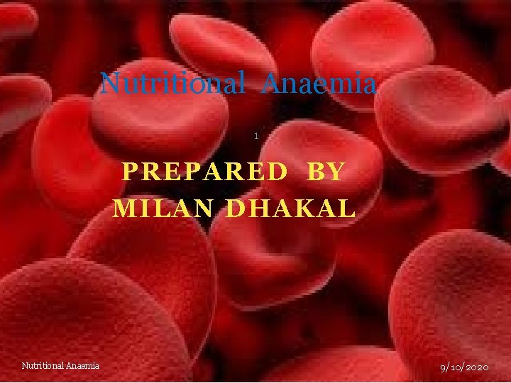 Nutritional Anaemia 1 PREPARED BY MILAN DHAKAL Nutritional Anaemia 9/10/2020 