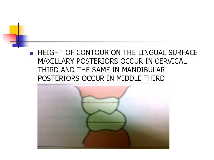 n HEIGHT OF CONTOUR ON THE LINGUAL SURFACE MAXILLARY POSTERIORS OCCUR IN CERVICAL THIRD