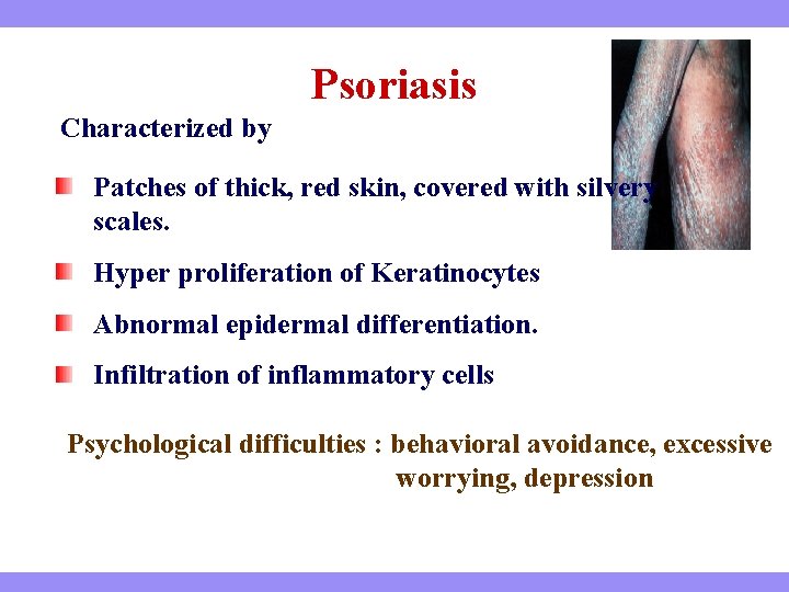 Psoriasis Characterized by Patches of thick, red skin, covered with silvery scales. Hyper proliferation