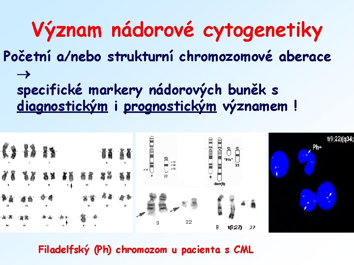 Význam nádorové cytogenetiky Početní a/nebo strukturní chromozomové aberace specifické markery nádorových buněk s diagnostickým