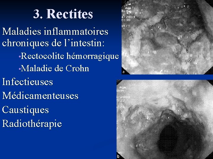 Proktos Rectum et anus DCEM 1 www proktos com