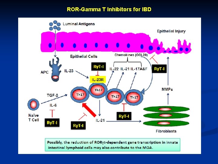 ROR-Gamma T Inhibitors for IBD 