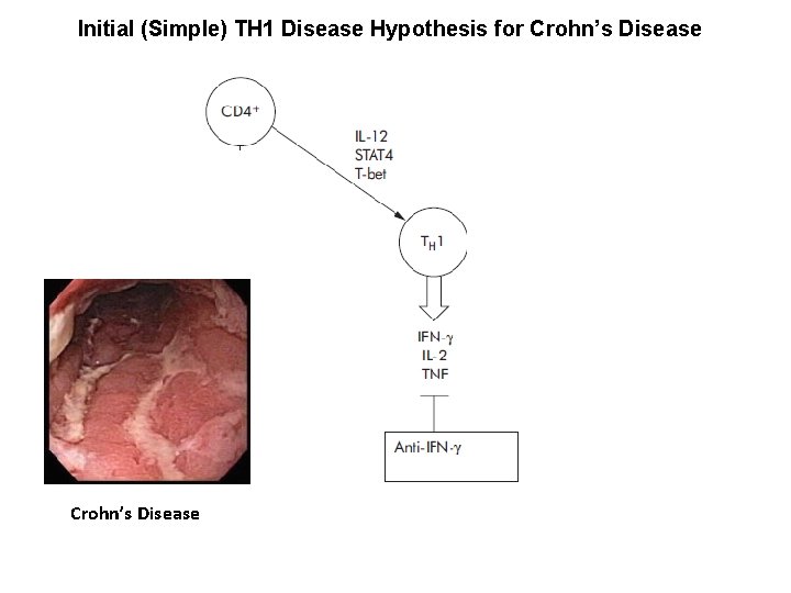 Initial (Simple) TH 1 Disease Hypothesis for Crohn’s Disease 