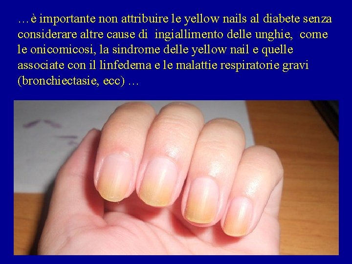 …è importante non attribuire le yellow nails al diabete senza considerare altre cause di