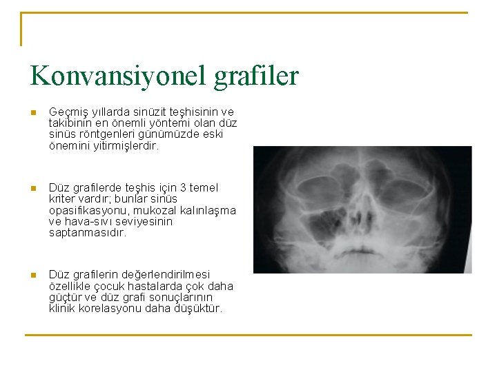 Konvansiyonel grafiler n Geçmiş yıllarda sinüzit teşhisinin ve takibinin en önemli yöntemi olan düz