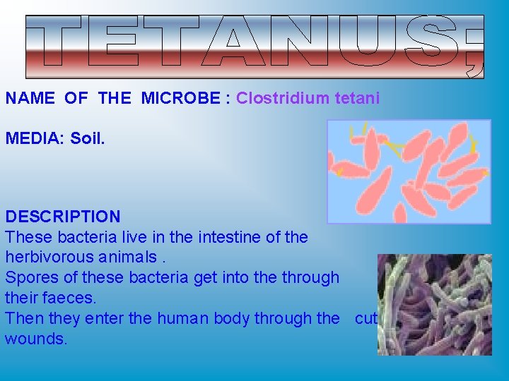 NAME OF THE MICROBE : Clostridium tetani MEDIA: Soil. DESCRIPTION These bacteria live in