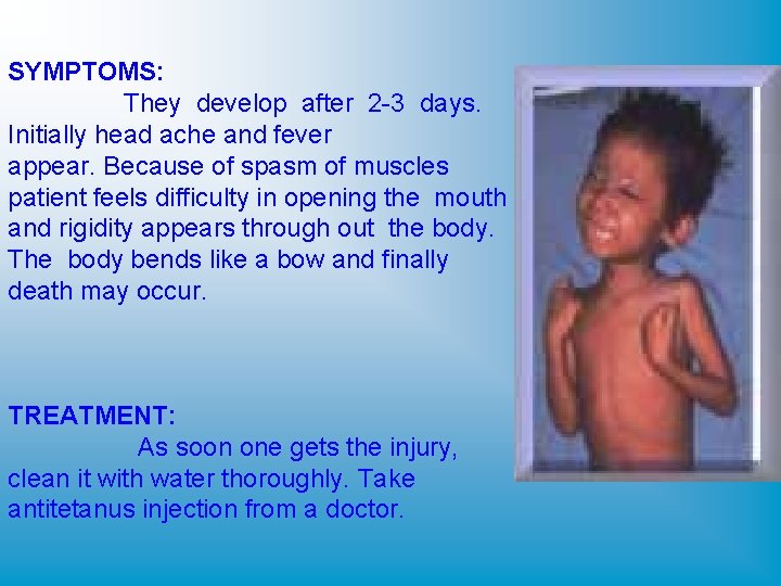 SYMPTOMS: They develop after 2 -3 days. Initially head ache and fever appear. Because