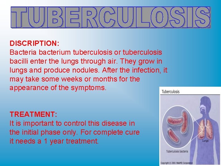 DISCRIPTION: Bacteria bacterium tuberculosis or tuberculosis bacilli enter the lungs through air. They grow