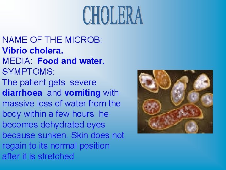 NAME OF THE MICROB: Vibrio cholera. MEDIA: Food and water. SYMPTOMS: The patient gets