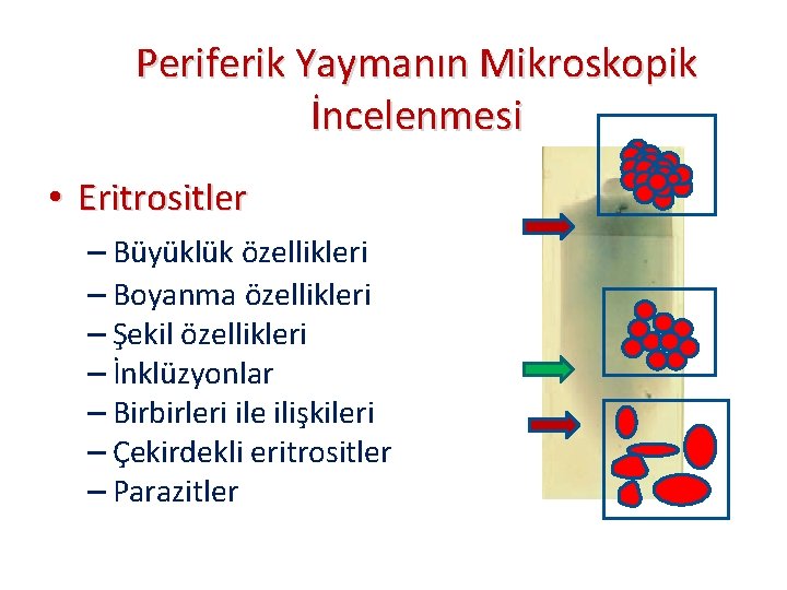 Periferik Yaymanın Mikroskopik İncelenmesi • Eritrositler – Büyüklük özellikleri – Boyanma özellikleri – Şekil