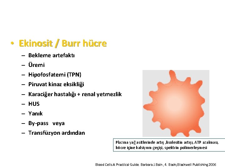  • Ekinosit / Burr hücre – Bekleme artefaktı – Üremi – Hipofosfatemi (TPN)