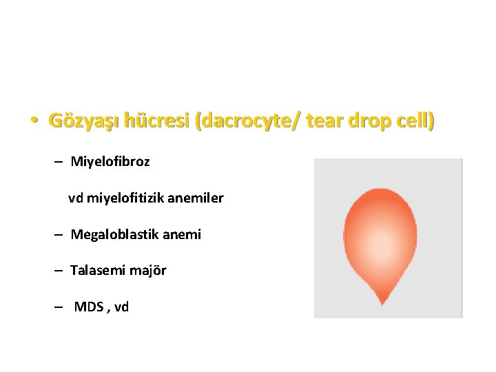  • Gözyaşı hücresi (dacrocyte/ tear drop cell) – Miyelofibroz vd miyelofitizik anemiler –