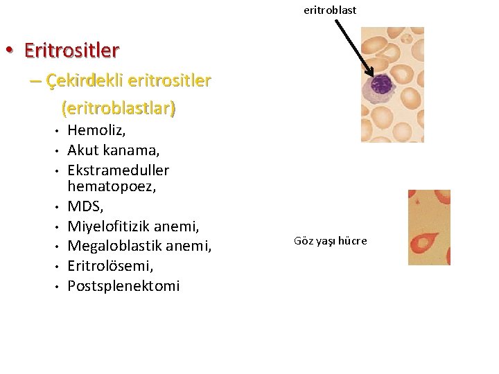 eritroblast • Eritrositler – Çekirdekli eritrositler (eritroblastlar) • • Hemoliz, Akut kanama, Ekstrameduller hematopoez,