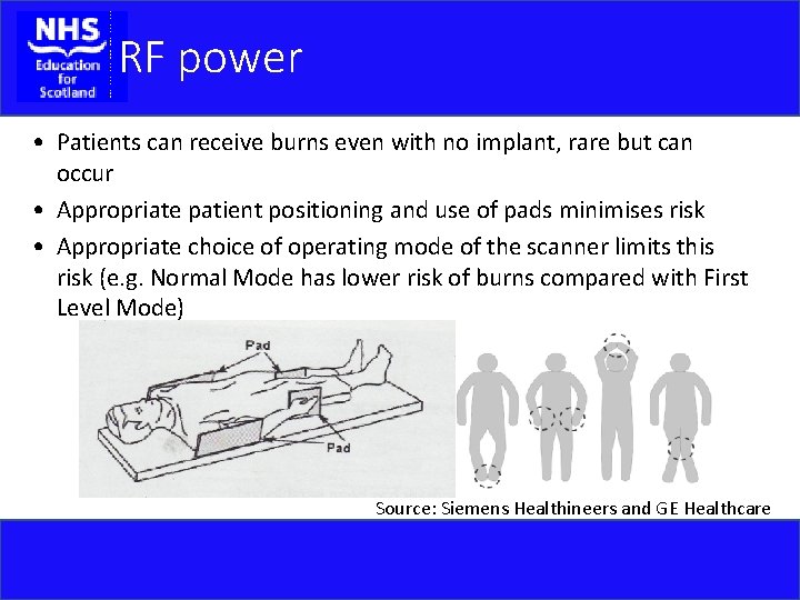 RF power • Patients can receive burns even with no implant, rare but can