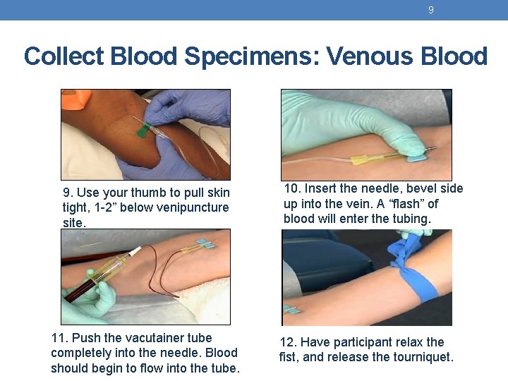 9 Collect Blood Specimens: Venous Blood 9. Use your thumb to pull skin tight,