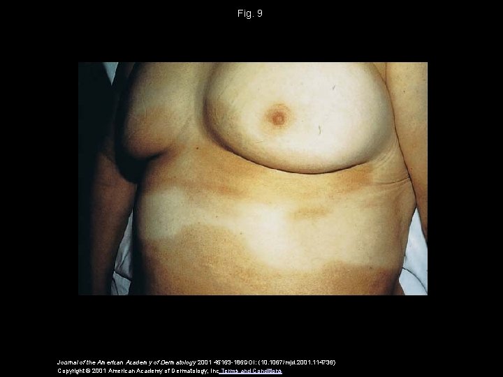 Fig. 9 Journal of the American Academy of Dermatology 2001 45163 -186 DOI: (10.