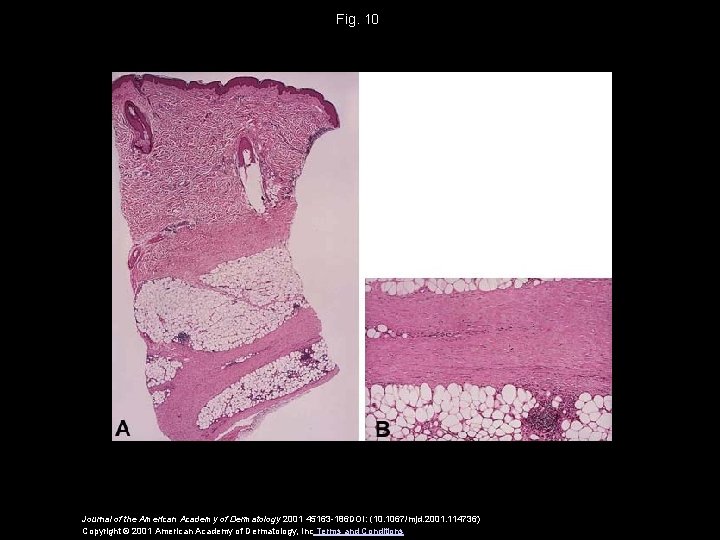 Fig. 10 Journal of the American Academy of Dermatology 2001 45163 -186 DOI: (10.